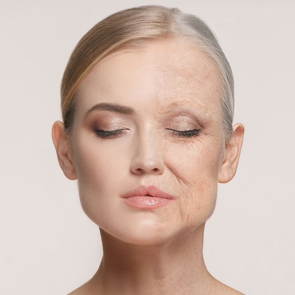 Full Face Contouring & Lift treatment in Dubai