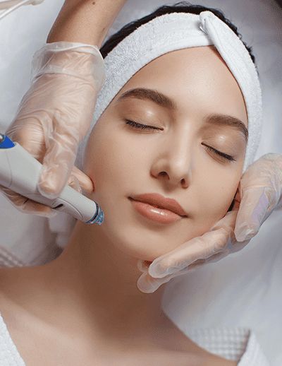 Microneedling treatment in Dubai