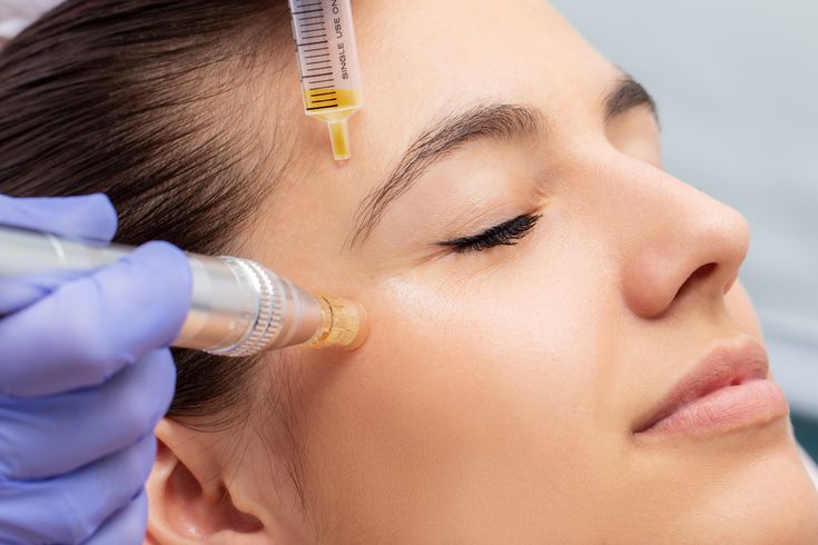 PRP Injection treatment in Dubai