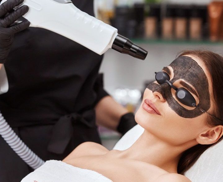 Carbon Laser Facial Benefits How It Works Side Effects e1713873466850